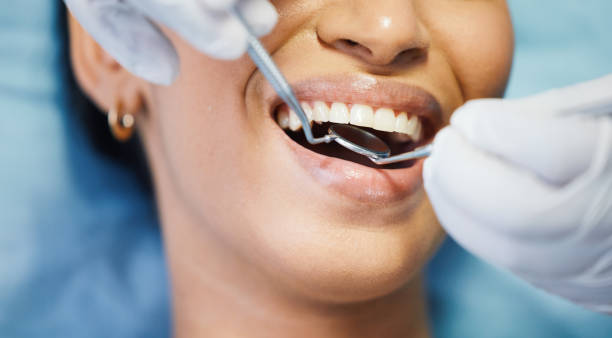 Best Emergency Denture Repair in Marion, KS