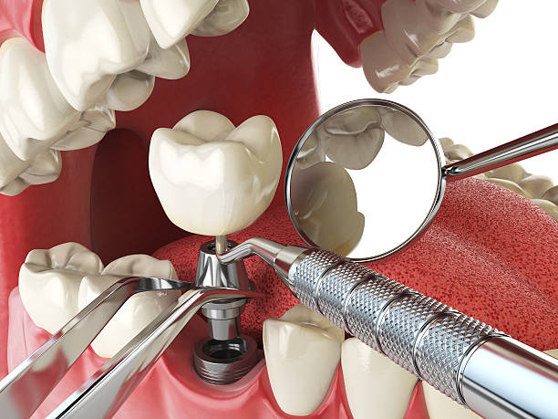 Best Emergency TMJ Treatment in Marion, KS